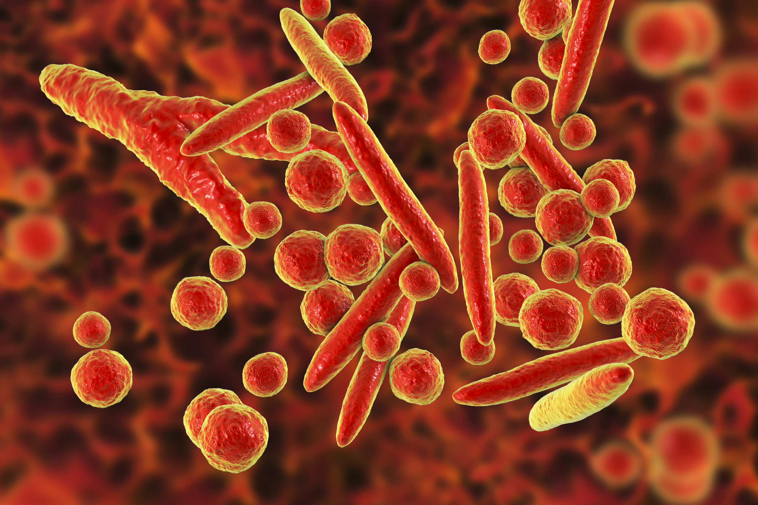 Neisseria Gonorrhoeae Positive RED 17 M1 Microbix Biosystems Inc 