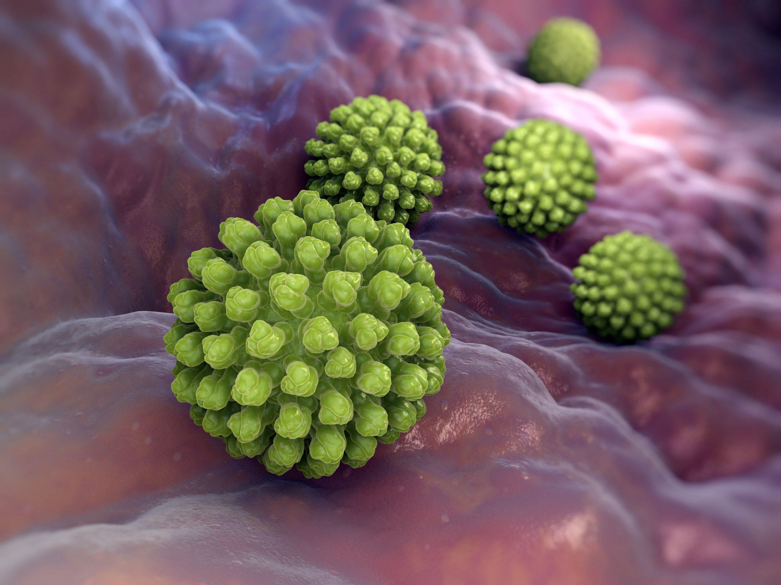 Rotavirus Grade 3