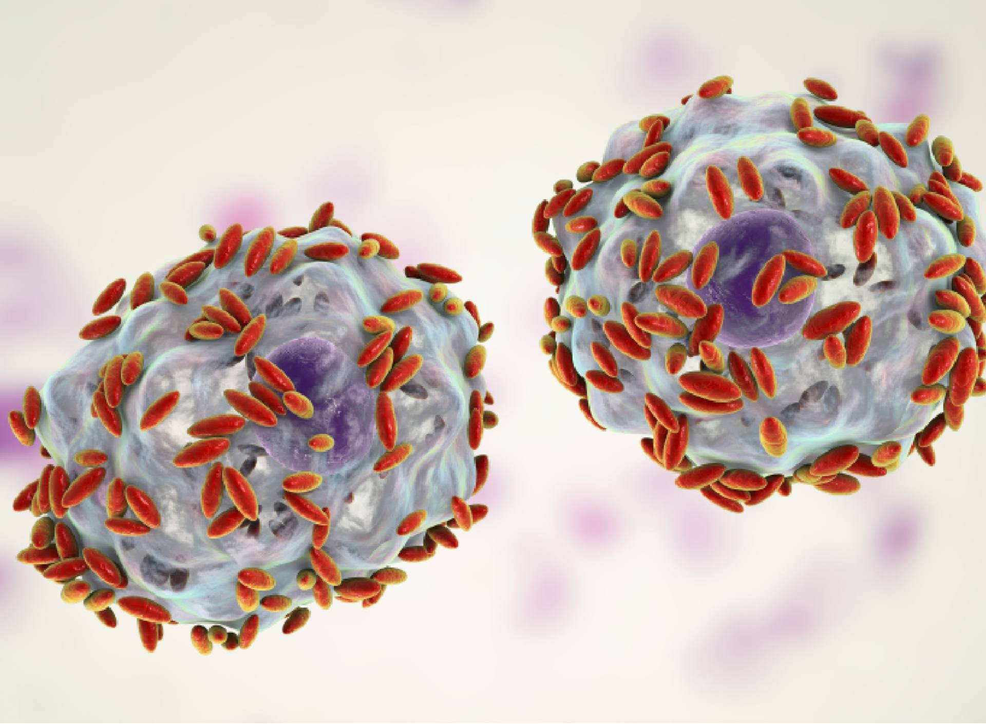 Bacterial Vaginosis