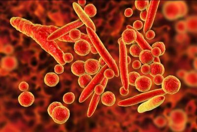 bacterial