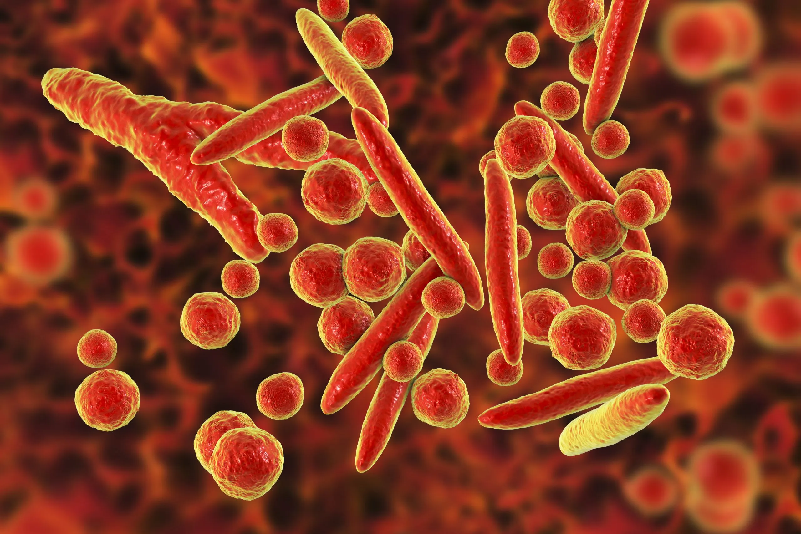 Trichomonas vaginalis Positive Swab - IVD REDx™