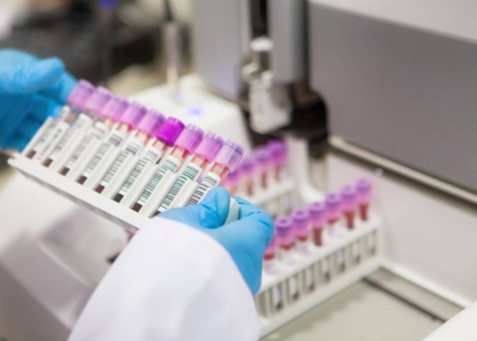 Microbix partnered with Bulgariaʼs National Center for Infectious and Parasitic Diseases (NCIPD)